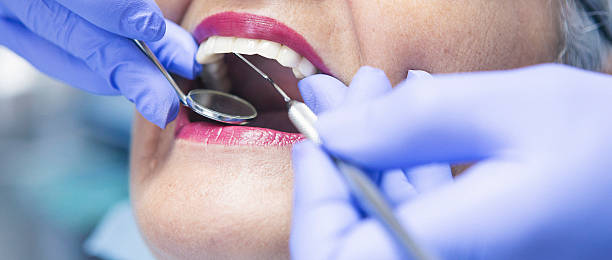 Best Emergency Dental Extractions in Parlier, CA